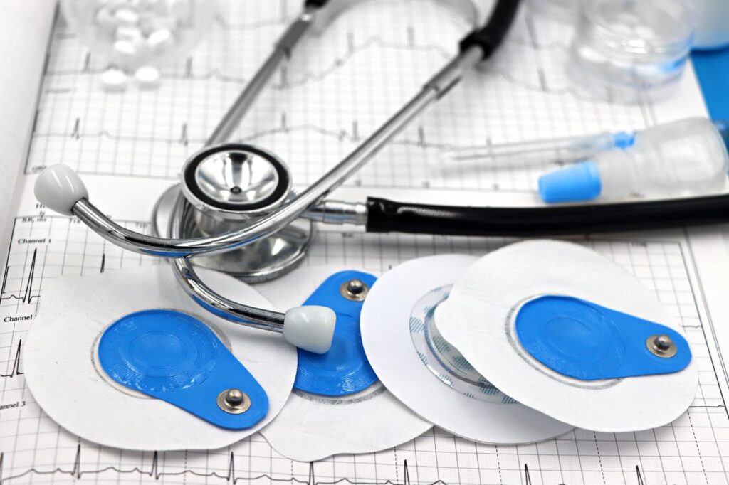 Close-up of medical tools including electrodes and stethoscope on ECG printout.